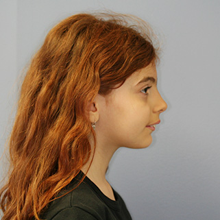 alessia before